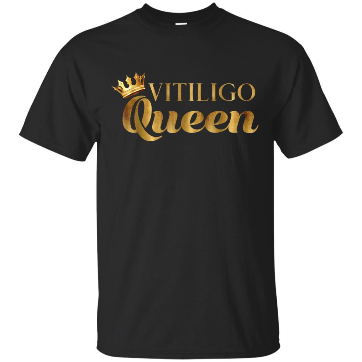 Vitiligo Queen T Shirt Vitiligo Awareness Funny Shirts T Shirts Tshirt Hoodie 5212